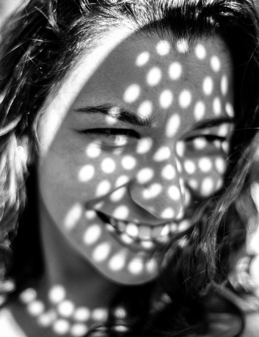 THINGS YOU NEED TO KNOW ABOUT ACNE PRONE SKIN