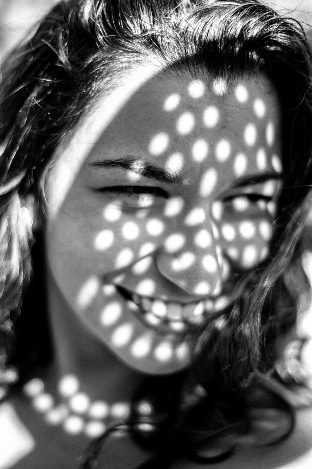 THINGS YOU NEED TO KNOW ABOUT ACNE PRONE SKIN