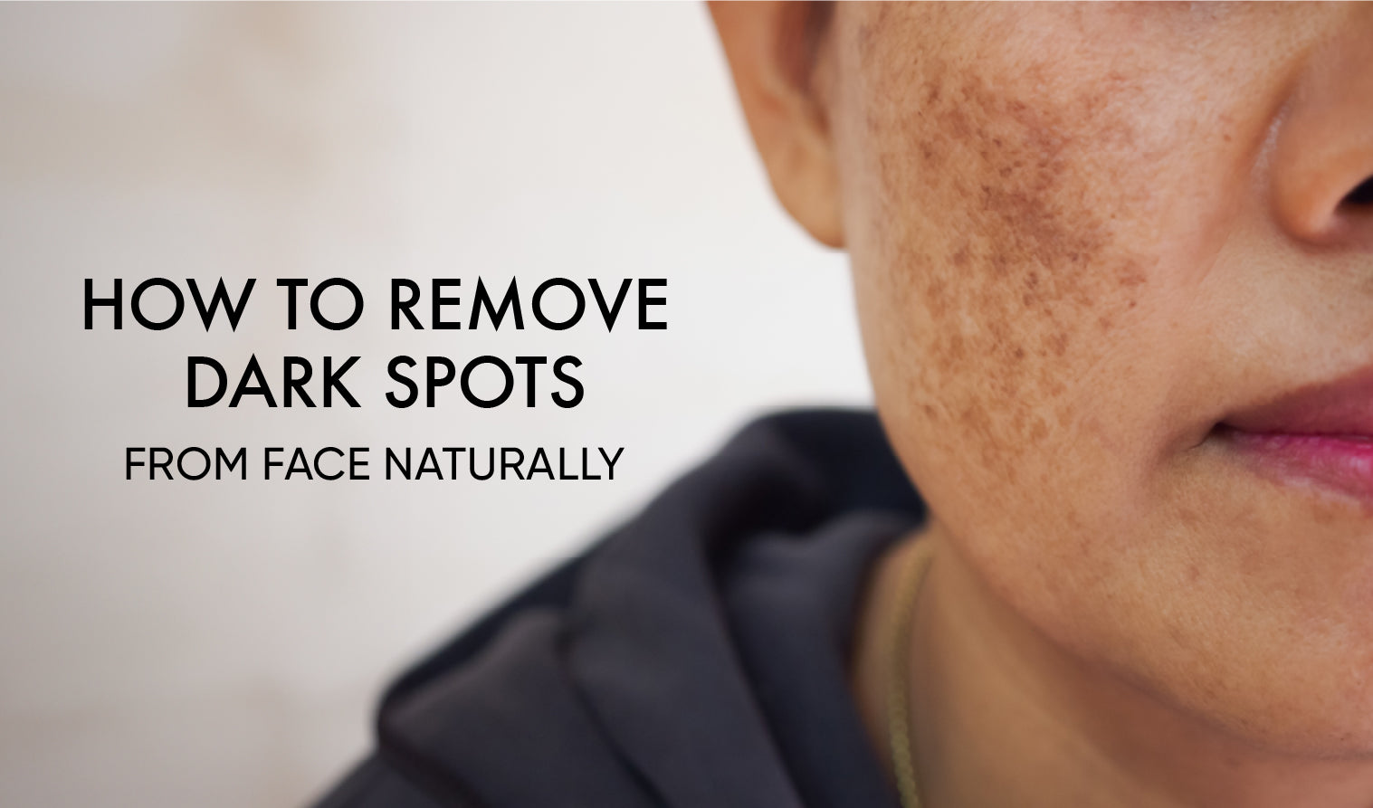 How to Remove Dark Spots from Face Naturally