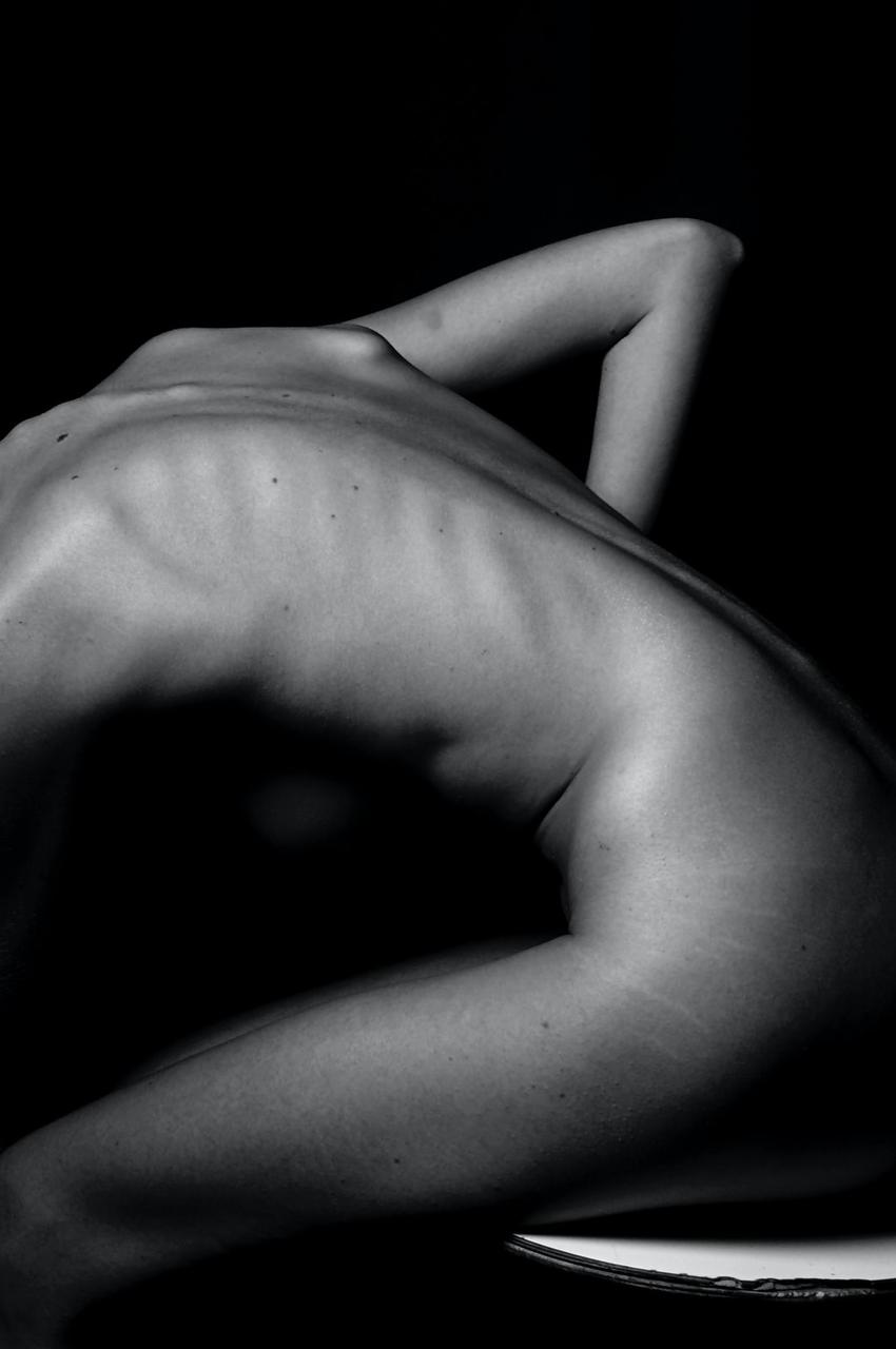 Fatigue, Laziness and Tired Sore Muscle Mass