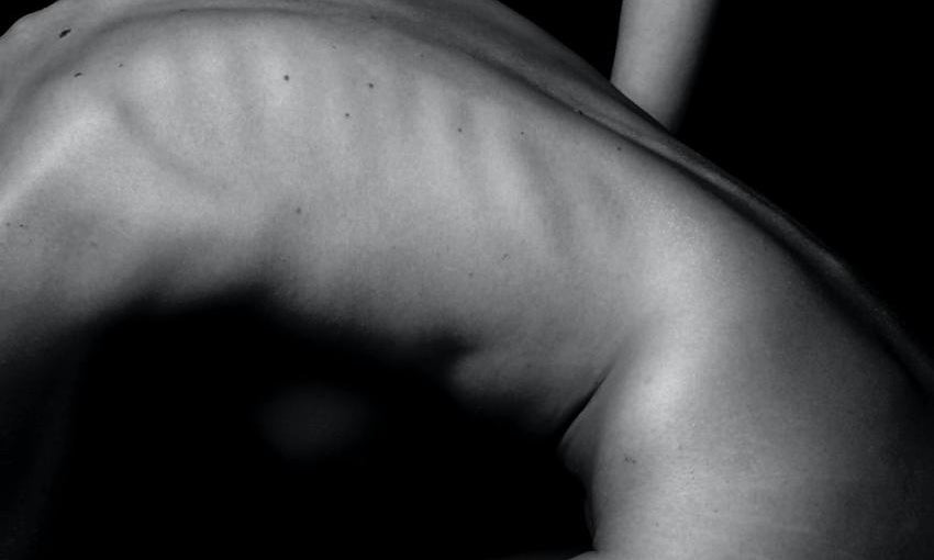 Fatigue, Laziness and Tired Sore Muscle Mass