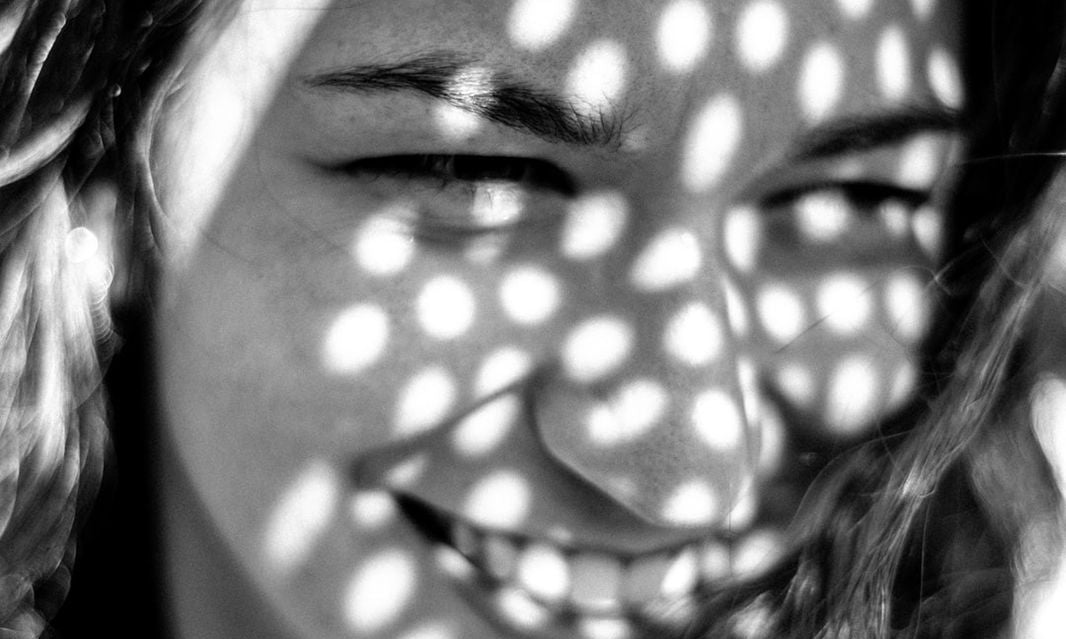 THINGS YOU NEED TO KNOW ABOUT ACNE PRONE SKIN