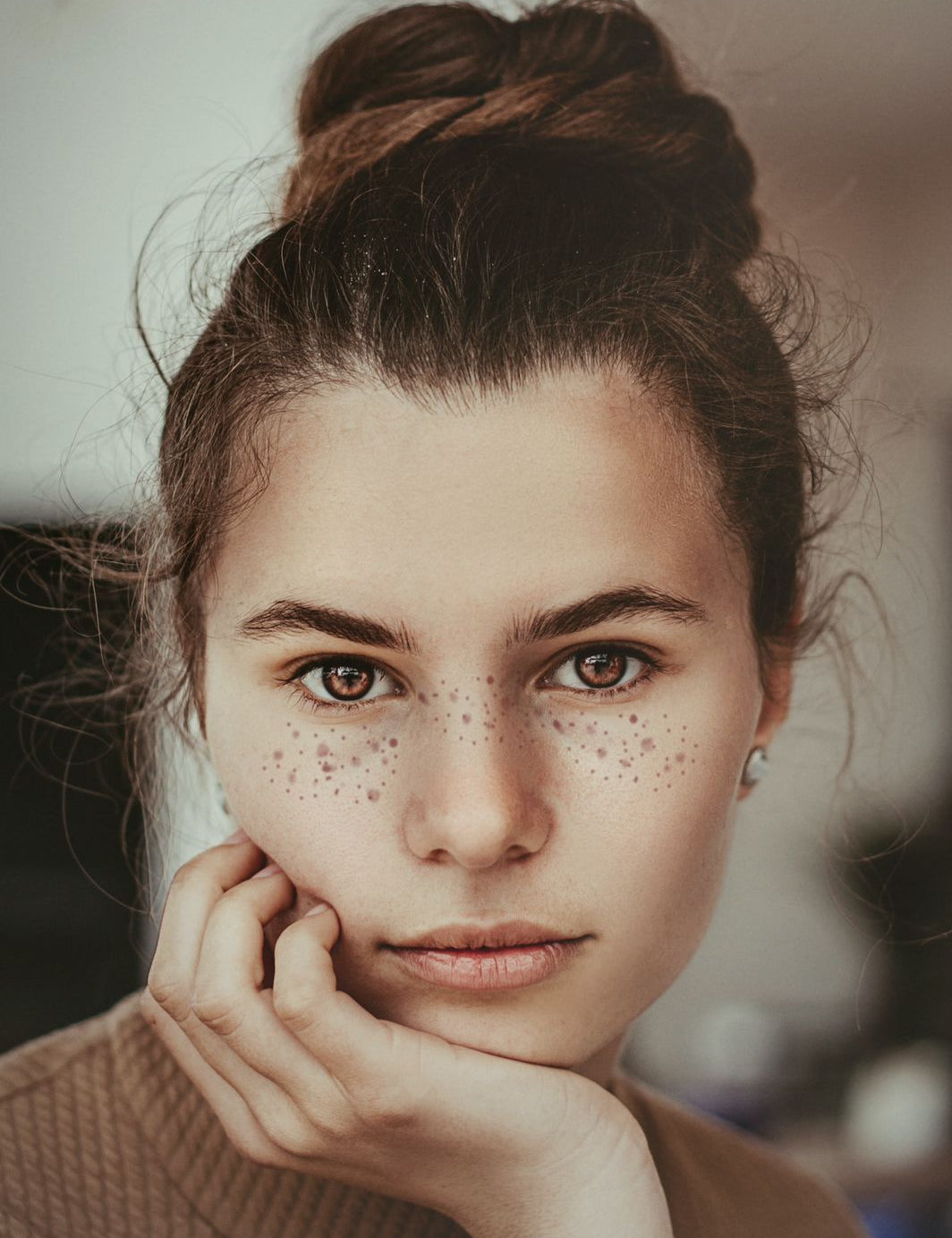 How to prevent acne?