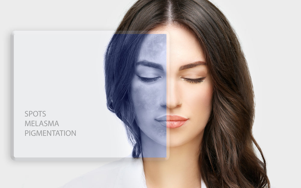 Serum Tran-Az, Mode of Action on Pigmentation