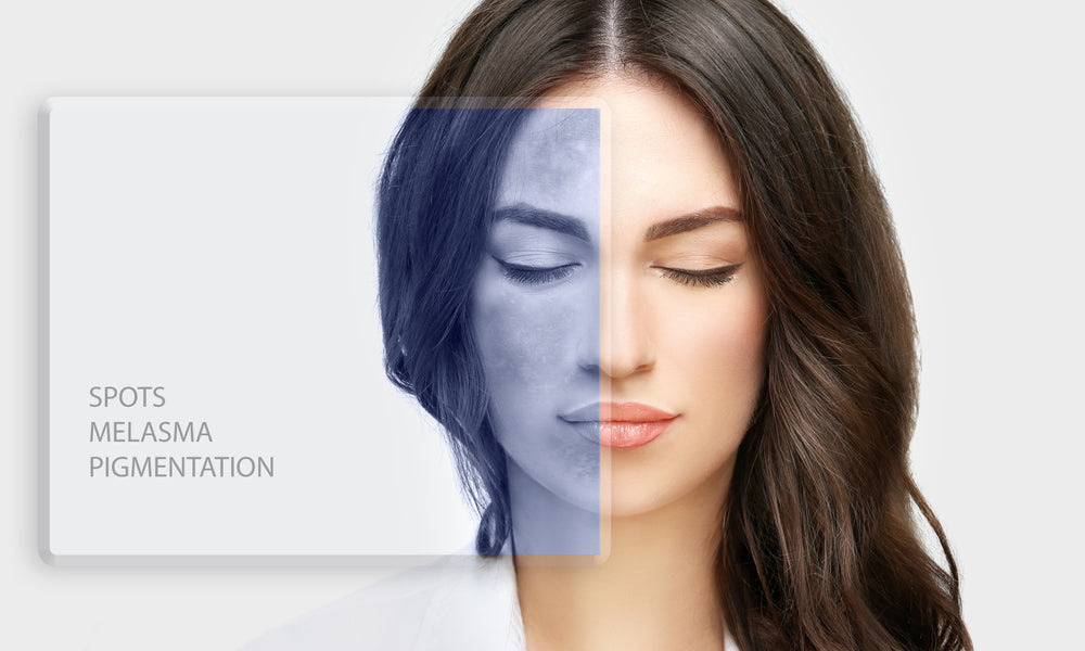 Serum Tran-Az, Mode of Action on Pigmentation