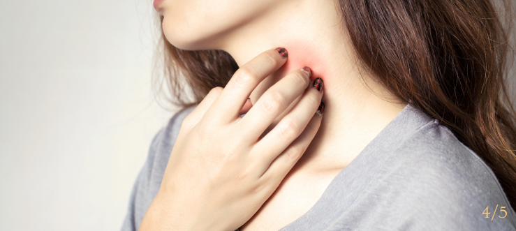Skin injuries Cause Image